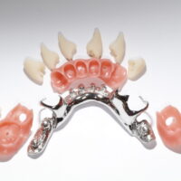 Quick Snap : Partial Framework + teeth + gingiva design
