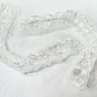 Aligner 10-20 Steps
