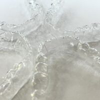 Aligner more than 20 Steps