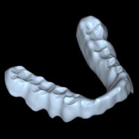Gerber Splint