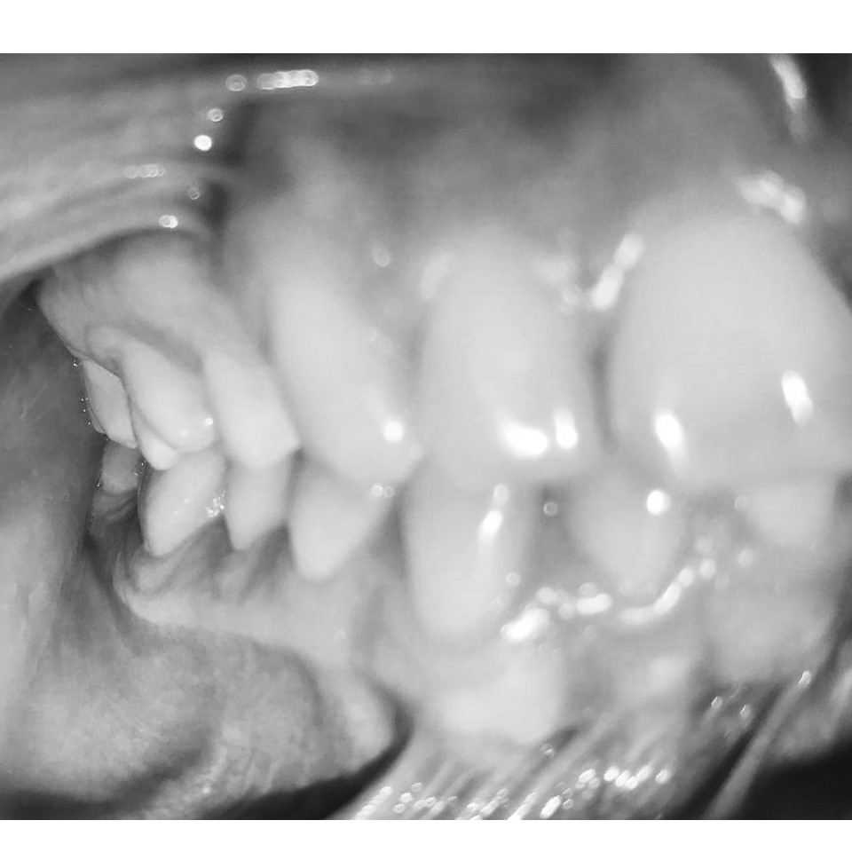 Aligner 1-10 Steps - Image 6