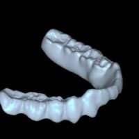 Therapeutic & Occlusal Splints