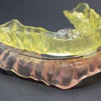 Serenight© Anti Snoring Splint