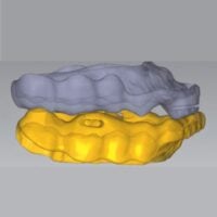 Anti Snoring Splint Design (Serenight ©) - Switzerland Only