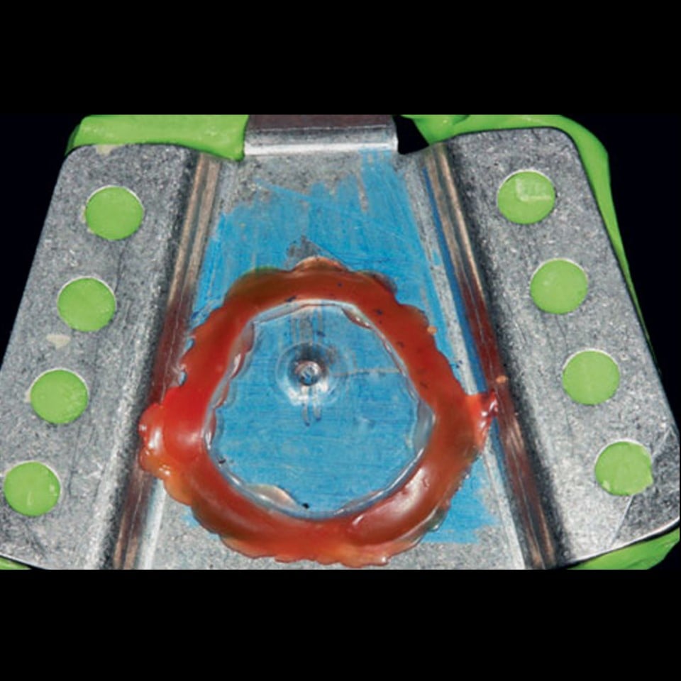 Anti Snoring Splint (Serenight©) – Finished Product - Image 9