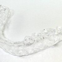 Aligner 1-10 Steps
