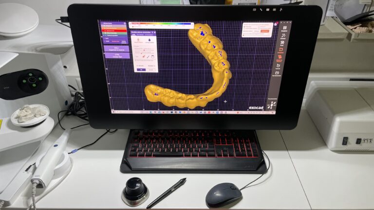 Cad Cam dental splint from Swiss 3D Dental Design Geneva